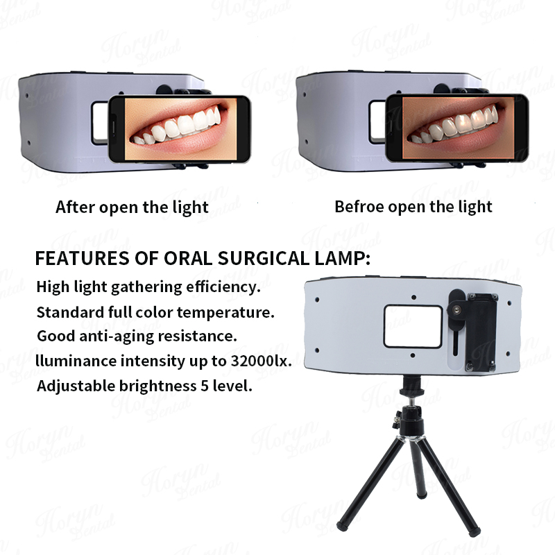 Dental Blitzlicht Fotografie A – Photography Lighting Flash Bewertung und Preis